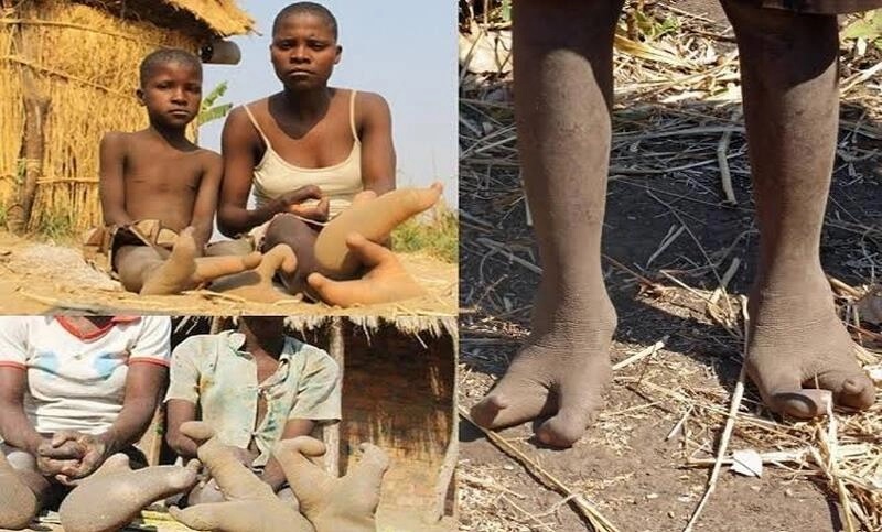 The legs of this tribe are very strange they look like pigeons people come from far and wide to see them