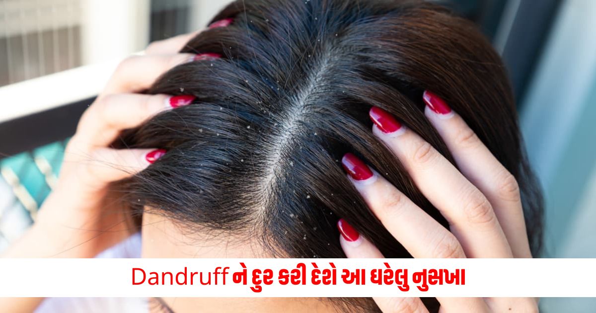 This home remedy will get rid of dandruff