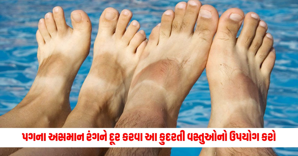 effective home remedies to remove tan from feet