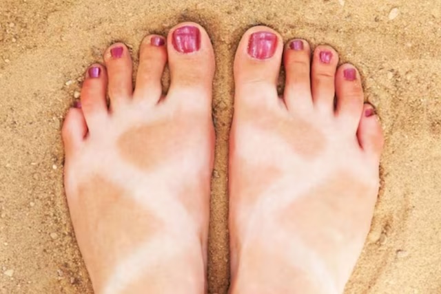 effective home remedies to remove tan from feet2