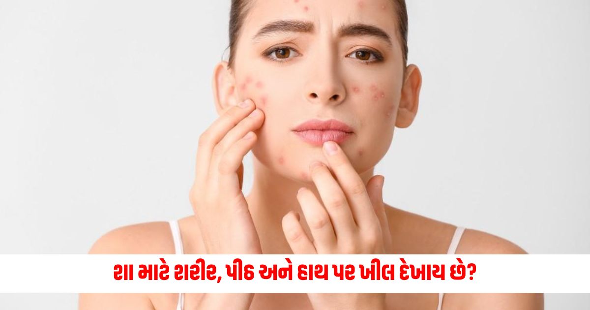 Why do acne appear on the body back and hands Try to reduce it with these tips