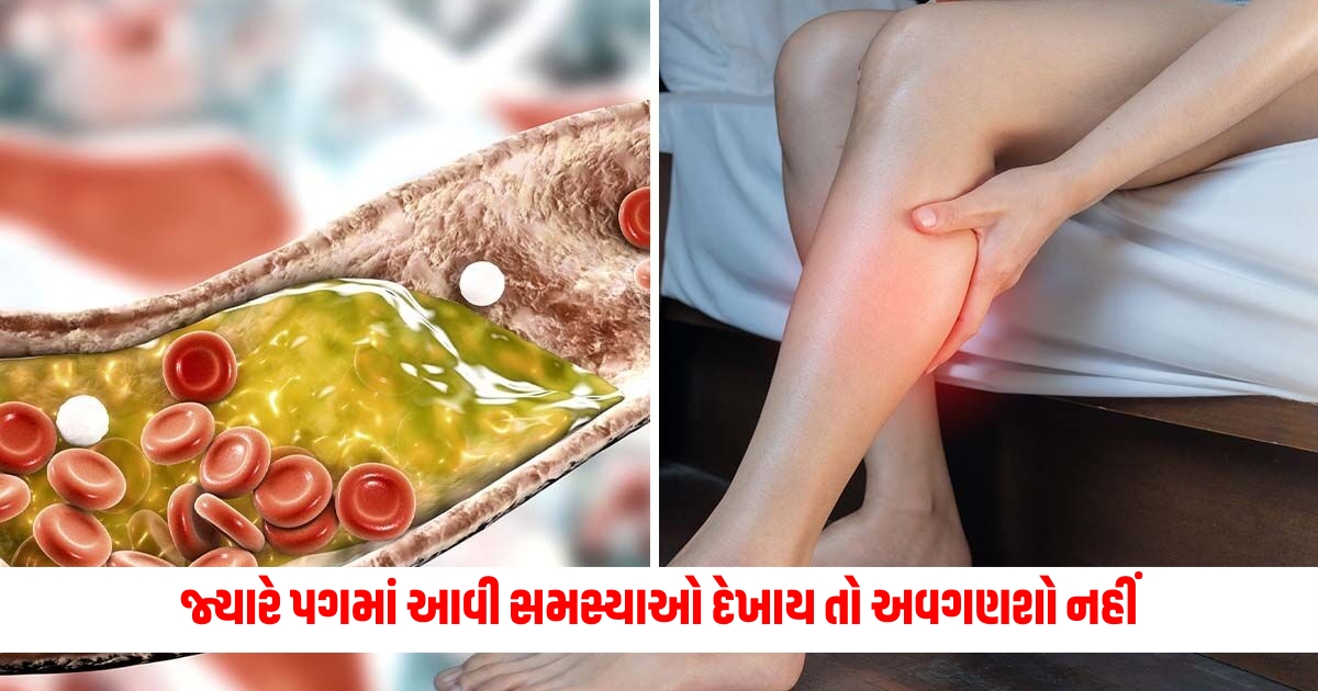 how to get high cholesterol symptoms from your feet leg pain skin colour cold toe