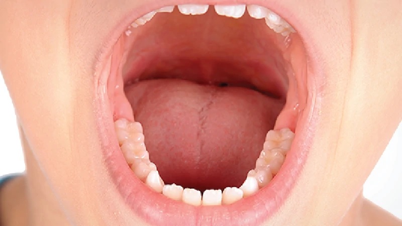 mouth cancer causes symptoms prevention and care tips 2