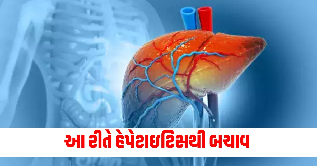 world hepatitis day 2024 expert shares tips to protect yourself from hepatitis during monsoon f