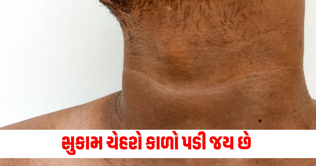 deficiency of this vitamin can cause skin darkening know about it in detail here f