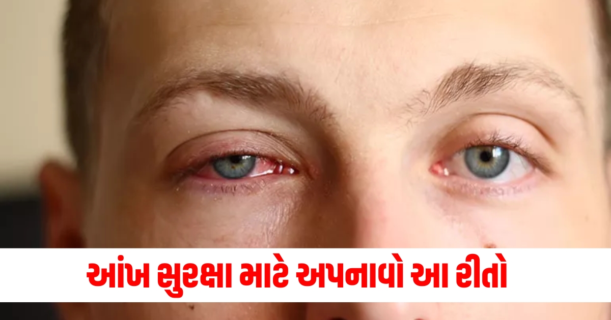 home remedies to prevent conjunctivitis or to get relief from pink eye f