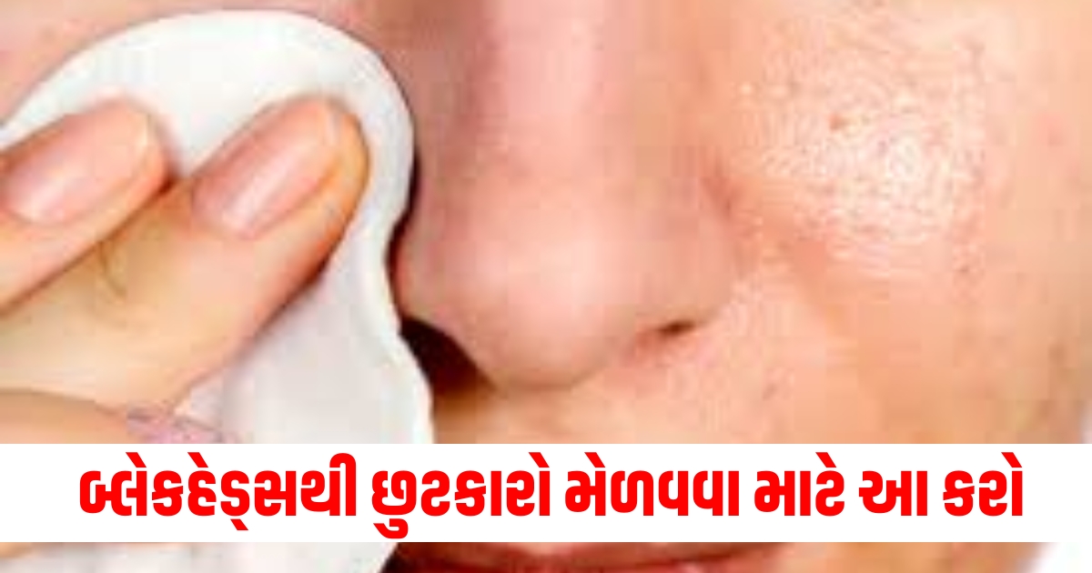 બ્લેકહેડ્સથી છુટકારો મેળવવા માટે આ ઉપાય કરો