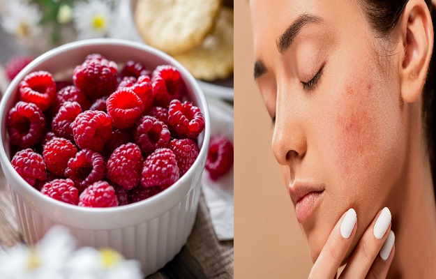 anti acne diet persistent acne breakout follow these dietary tips to get relief2