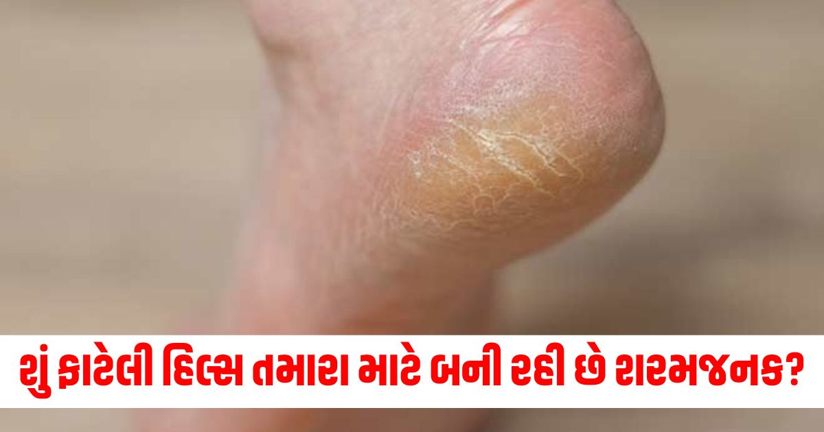 how to heal cracked heels with raw turmeric mustard and rosemary oil article