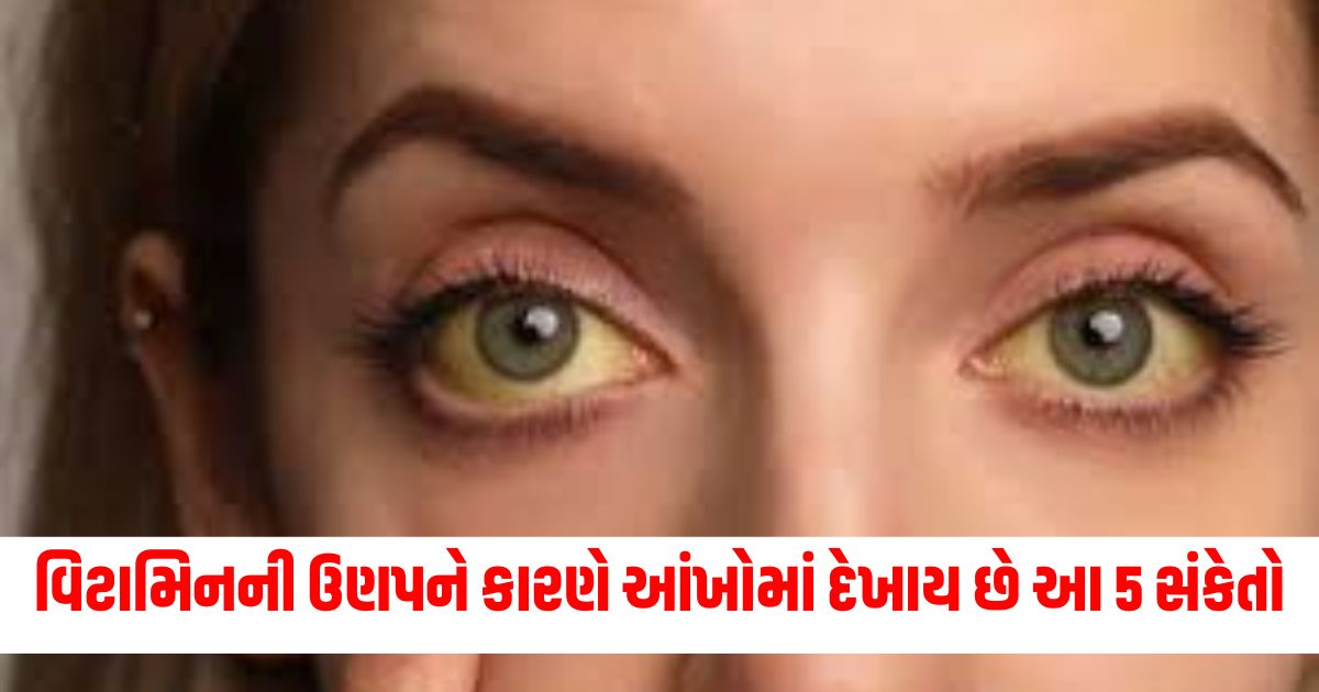 how vitamin b12 deficiency affect your eyes know top 5 sypmtoms here vitamin b12 ki kami ke lakshan