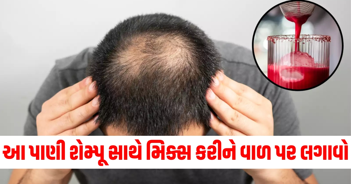 આ પાણી શેમ્પૂ સાથે મિક્સ કરીને વાળ પર લગાવો