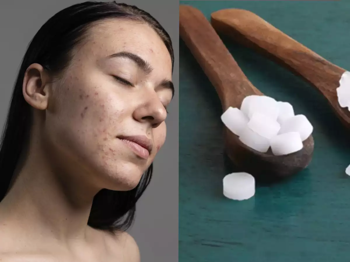 benefits of camphor for skin and effective ways to use it435