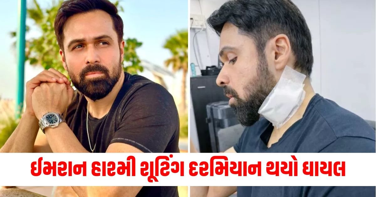 emraan hashmi gets injured while shooting of adivi sesh goodachari 2 in hyderabad૨૩૪