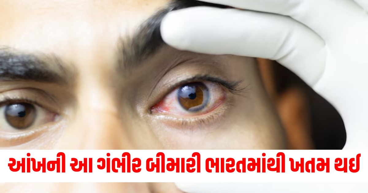 eye disease trachoma eliminated from india who announced know how dangerous or symptoms