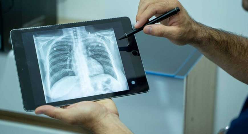 india made indigenous hand held x ray machine to test tb342