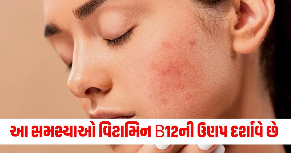 signs and symptoms of vitamin b12 deficiency on skin vitamin b12 ki kami ke twacha par lakshan23