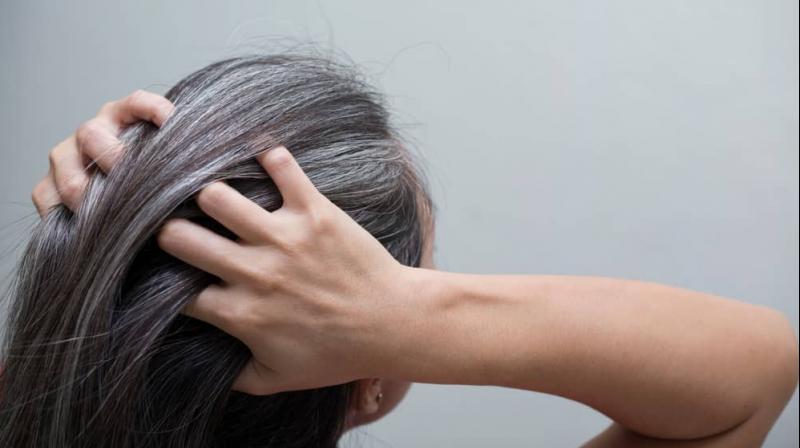 why hair starts turning gray at an early age prevent it in these 6 wayswert