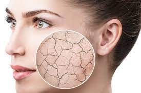 winter skin care tips for dry skin tips to improve skin during wintersewrwe