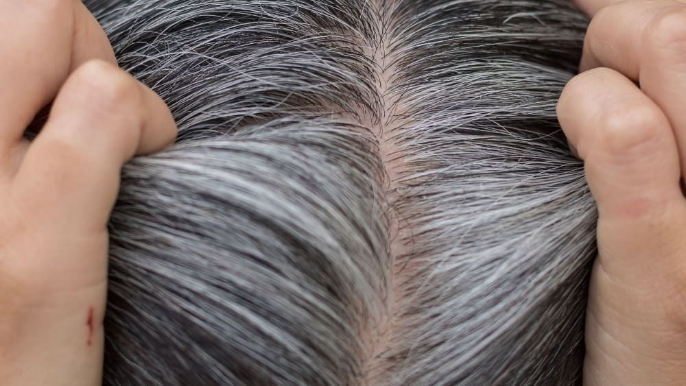 if your hair is turning grey then do these 3 remedies this problem will go away in just 4 weeks1