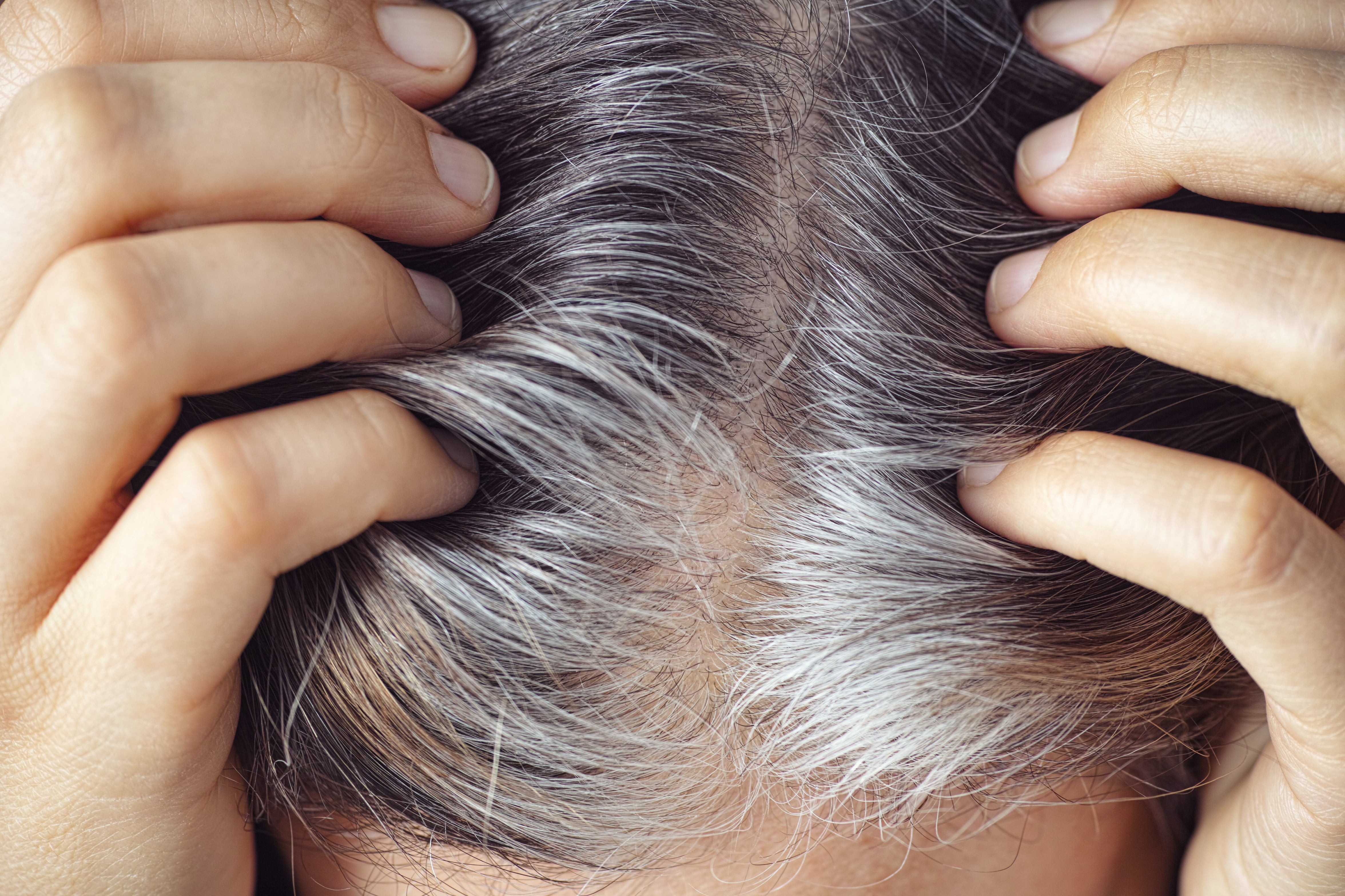 if your hair is turning grey then do these 3 remedies this problem will go away in just 4 weeks2