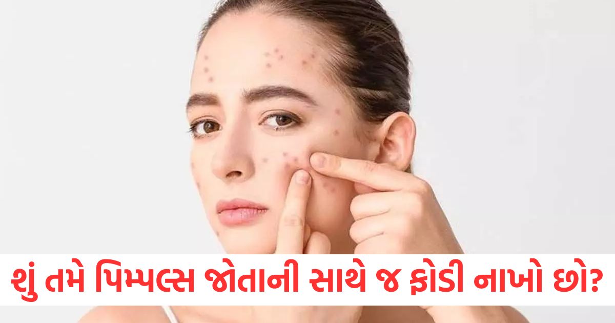 beauty you should not burst pimples as soon as you see them know the myths and facts