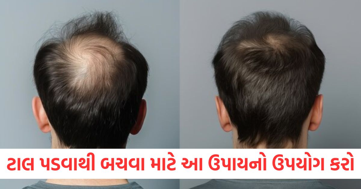 to avoid baldness use this remedy twice week effect visible in few months