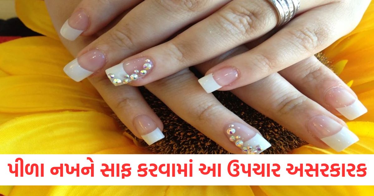 these home remedies effective in cleaning yellow nails not have to visit the parlor2