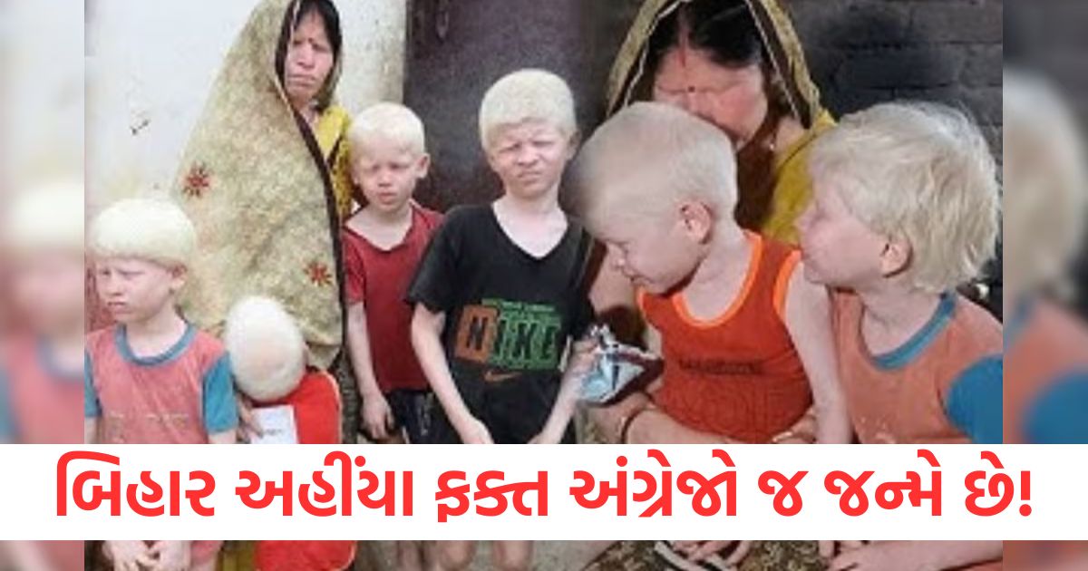 બિહારનો એક પરિવાર, જ્યાં ફક્ત અંગ્રેજો જ જન્મે છે! દરેક સભ્ય દૂધ જેવા સફેદ bihar gopalganj family suffers from genetic disease albinism people call britishers