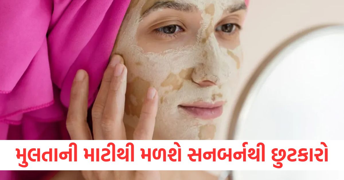 cure sunburn with multani mitti know how to use it