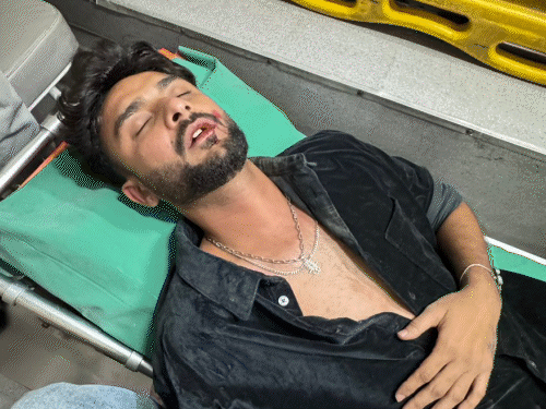 Song credit controversy Hardil Pandya attacked at Palladium Mall eardrum ruptured unable to sing for 4 months