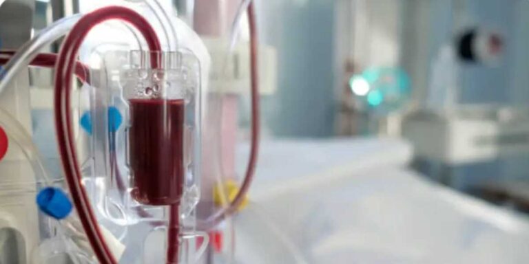 Crores of irregularities in dialysis purchase Health Departments surprise visit creates stir